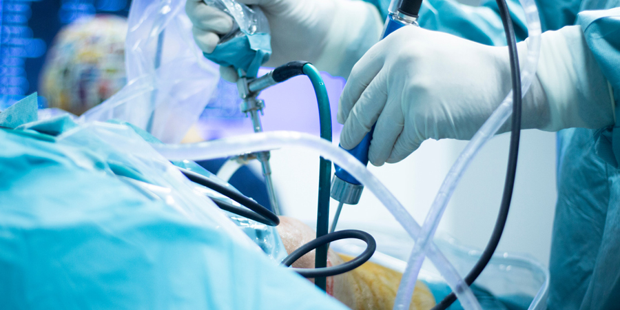 General & Laparoscopic Surgery