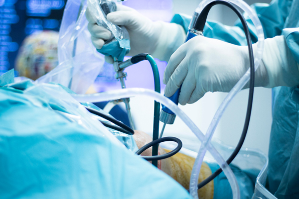 General & Laparoscopic Surgery